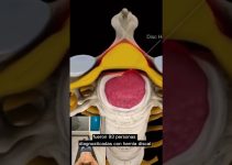 diagn&oacute;stico previo a intervenci&oacute;n compleja