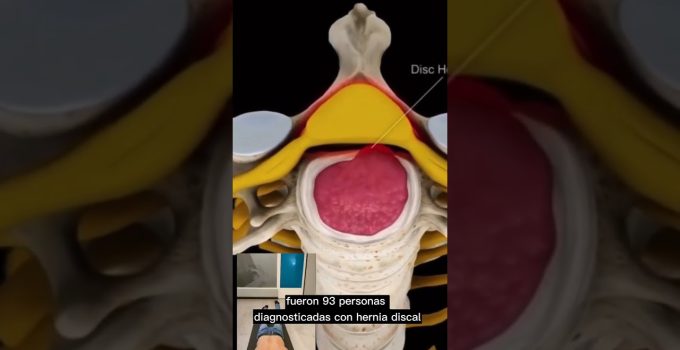 diagnóstico previo a intervención compleja