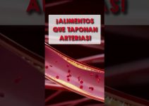 eliminaci&oacute;n de obstrucciones severas