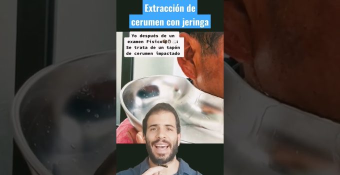 extracción de tapones compactos