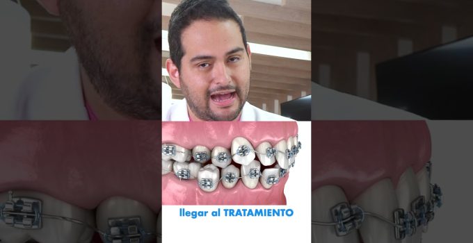 revisión de tuberías con crecimiento radicular